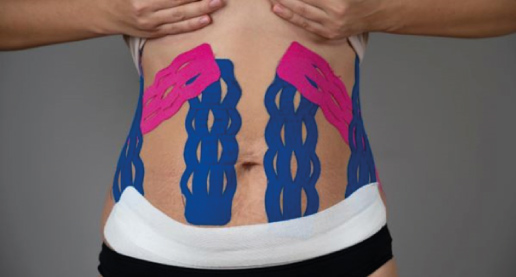 Fisioterapia-img
