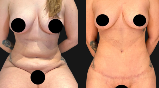 diferente-img-plastica