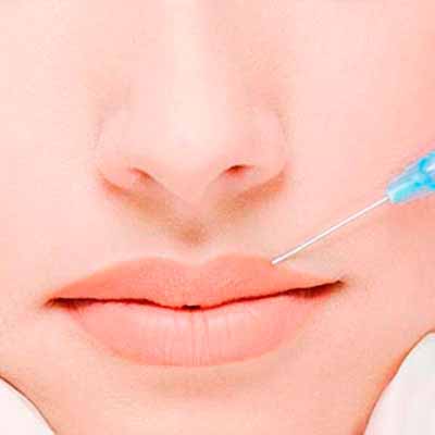 Preenchimento Facial em Porto Alegre